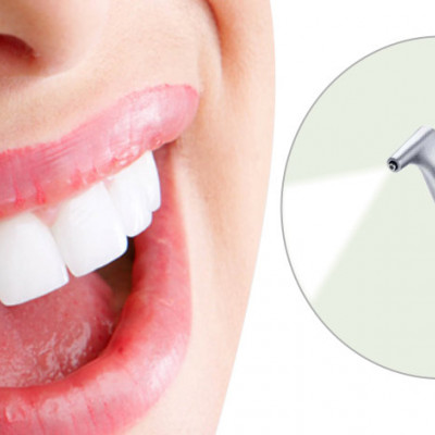 Чому для гігієни зубів ми не використовуємо ультразвук та соду